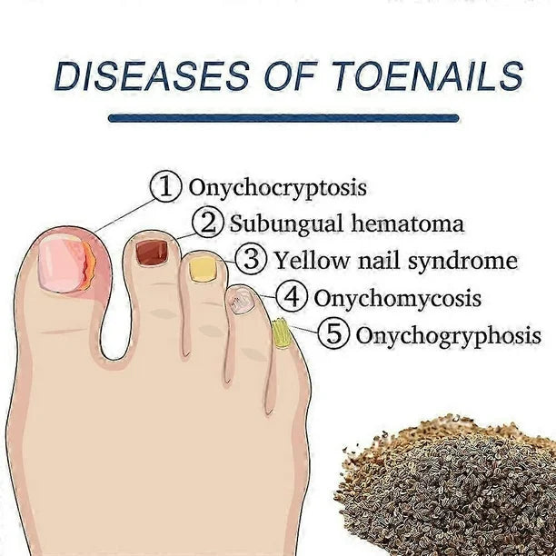 ¡Recupera la salud y belleza de tus uñas! Nuestros parches antifúngicos eliminan hongos de forma segura y efectiva mientras duermes. Resultados visibles en pocas semanas.